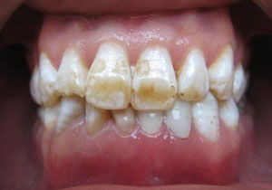 0ab66aa1ea412652-2ad26625cb51f3e5-dd13121e16912e198c9147374dd2f903.jpg