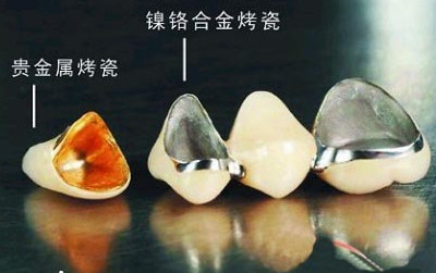 Ǯ