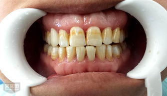 cae8823dfaba1e84-29f743b6af491a20-a5bfed3c8c24e3b67cf2b5b7fe9ad412_i.jpg