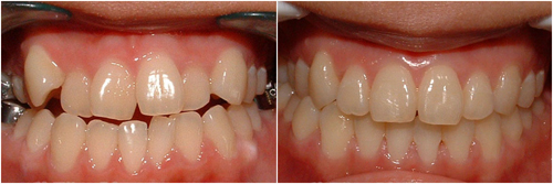 1-12110G1141N27.jpg