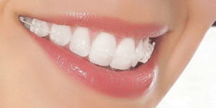 d97cbe04be84fc58-fadd50afda41a8c8-e5d9534b161bff2804c62b093b06ddda.jpg