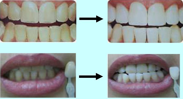 ϴ2.jpg