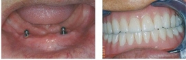 3-130G316295a22.jpg