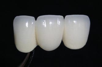 u=2924208824,962786388&fm=21&gp=0.jpg
